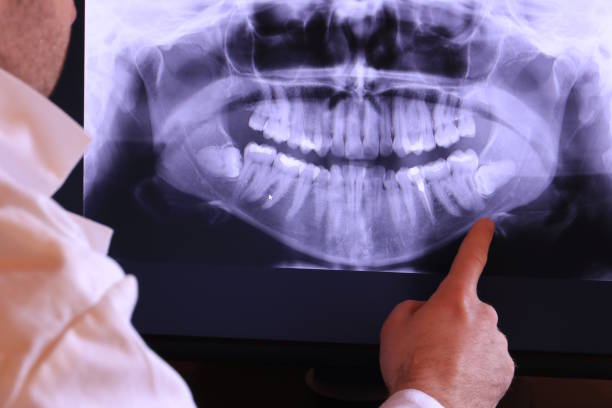 Best Emergency Dentist Open Today  in South El Monte, CA
