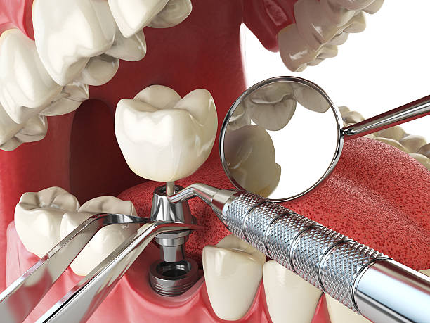 Best Dentist for Dental Trauma  in South El Monte, CA